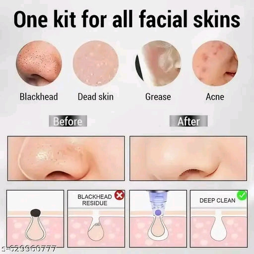 Blackhead Remover Device with 4 Suction Heads